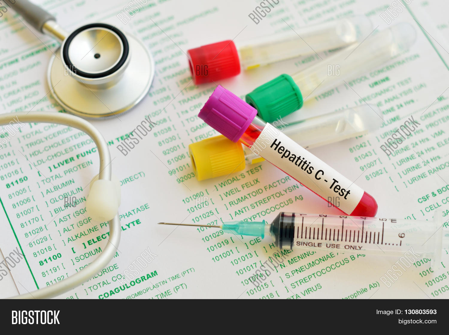 Imagen y foto Test Tube Blood Sample Hepatitis C Bigstock
