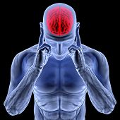foto of cerebral  - a man with a headache under x - JPG 