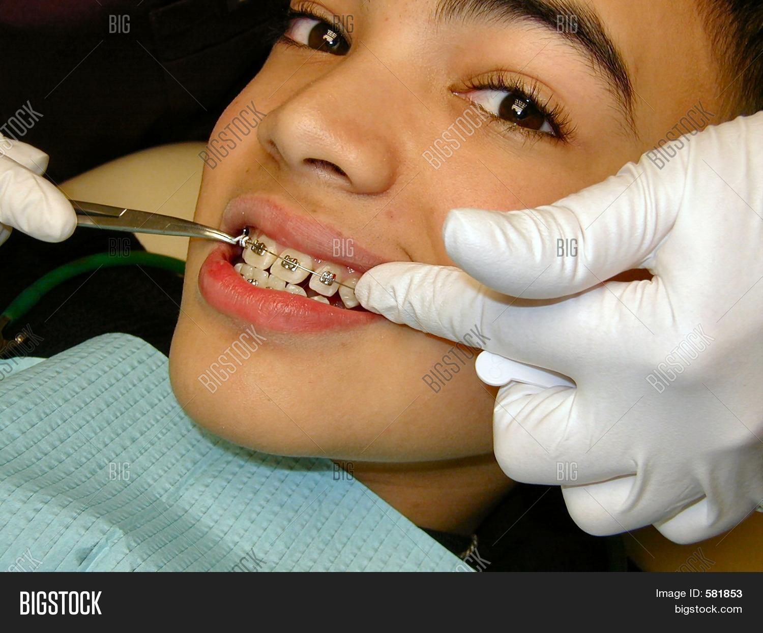 Fitting Of Braces Stock Photo & Stock Images Bigstock
