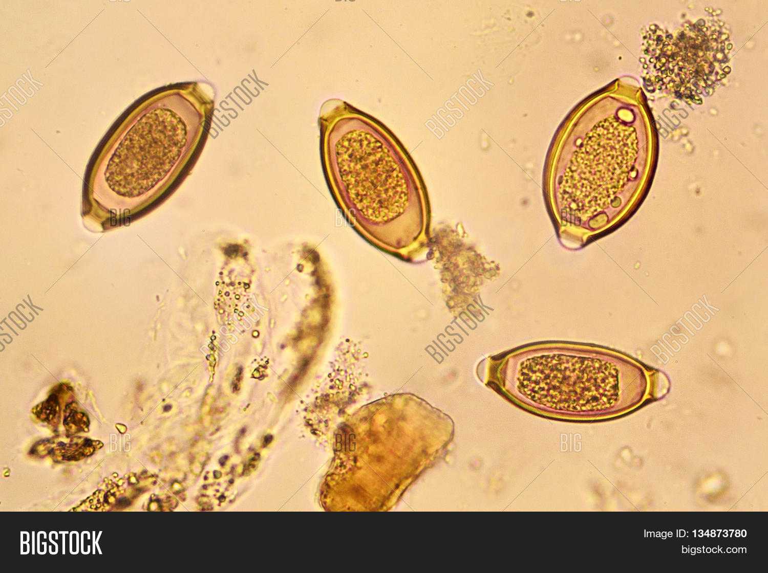 Egg Helminth Stool, Analyze By Image & Photo Bigstock