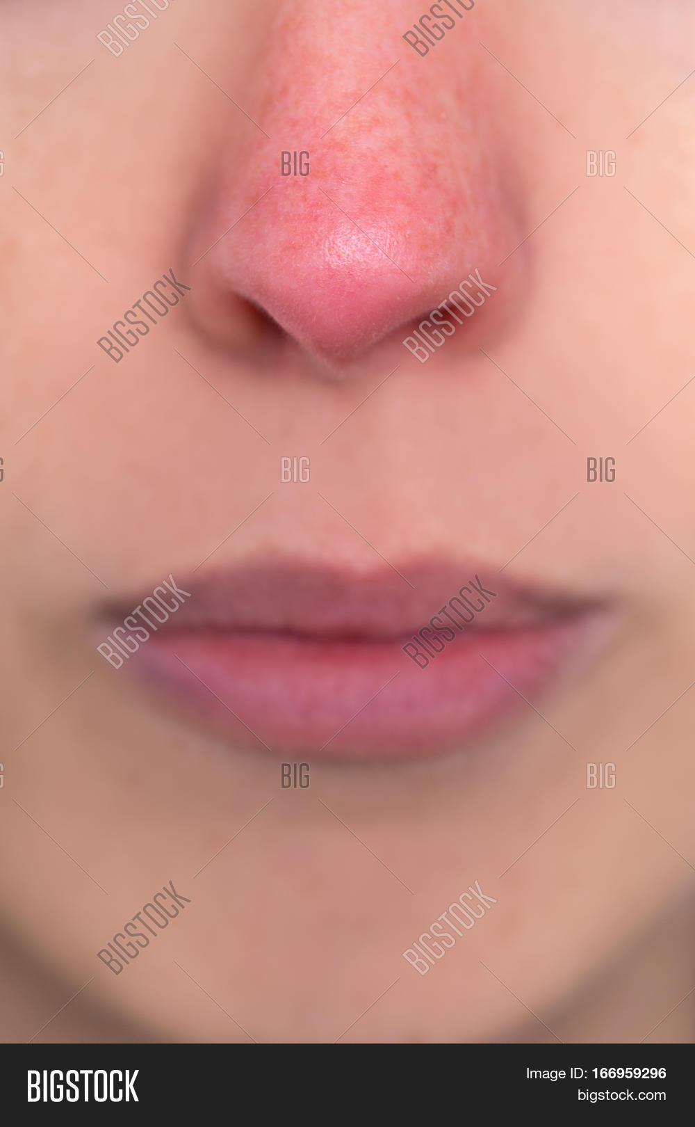 Close Up, Woman With A Red Nose, Allergy, Hypothermia Or Rosacea Stock