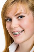 picture of bites  - Beautiful young woman with brackets on teeth close up - JPG 