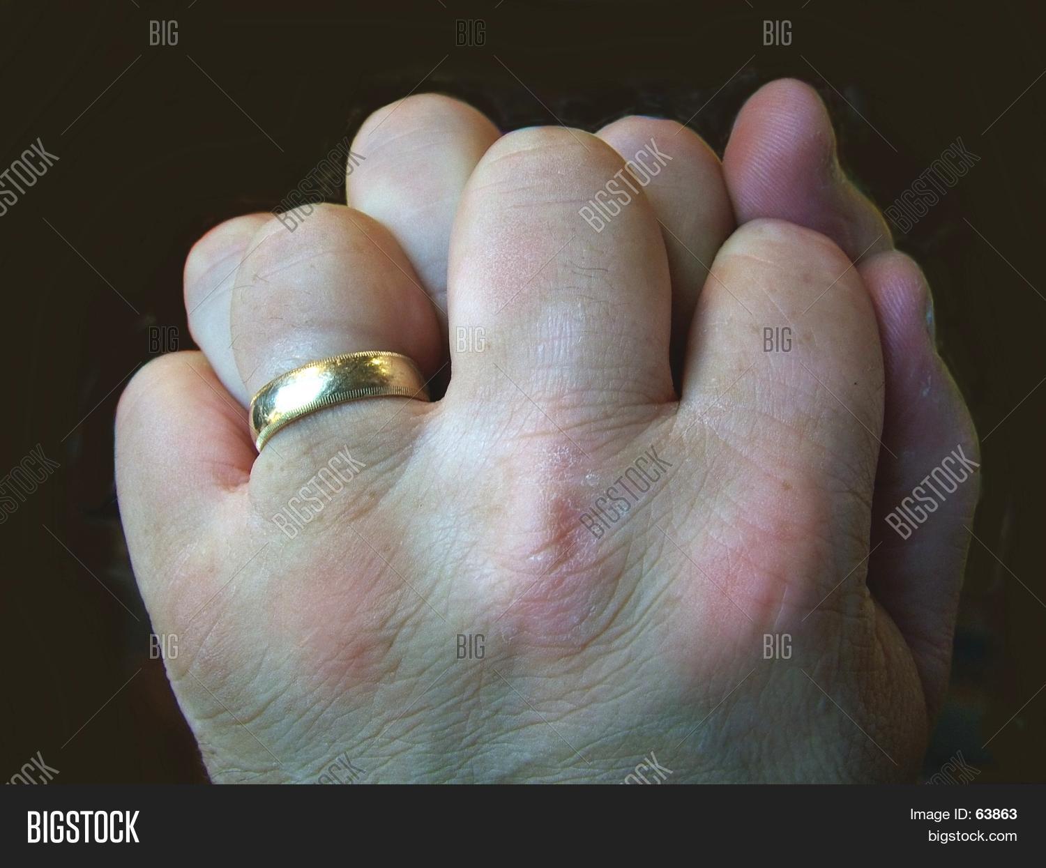 Rough Hands Image & Photo Bigstock