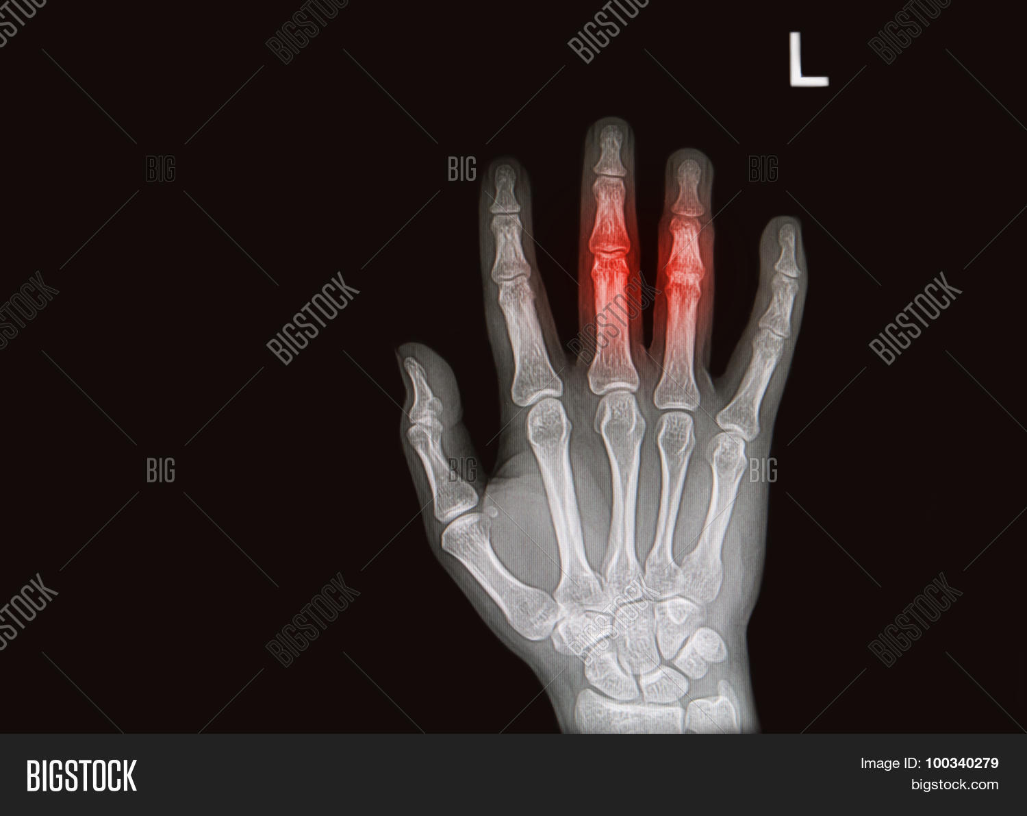Injury Painfull Image & Photo (Free Trial) Bigstock