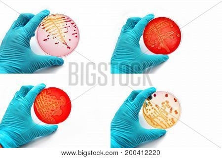 Mixed of bacteria colonies in various petri dish