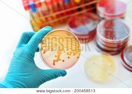 Colonies of bacteria in petri dish (MacConkey agar)