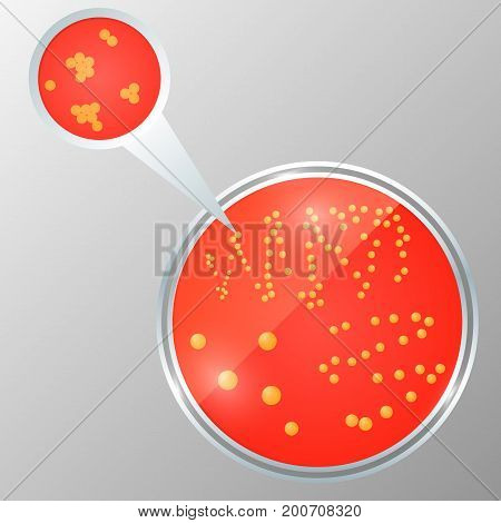 Realistic vector illustration of petri dish with bacteria isolated. Staphylococcus colony on the agar plate. Eps10