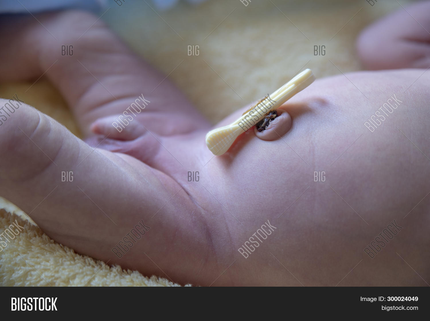 umbilical-cord-cut-image-photo-free-trial-bigstock