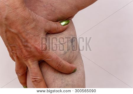 Elderly woman in white panties shows cellulite and varicose veins on a light isolated background. Co