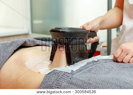 Cryolipolysis Freeze Fat Procedure In Cosmetic Cabinet Or Spa Salon, Belly Close-up