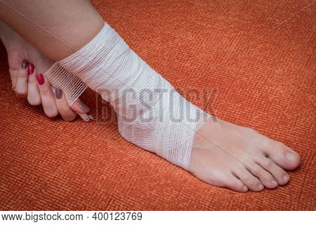 Bandaged Female Lower Leg With Gauze Bandage. Bandaged Shin Closeup Against The Background Of The Su