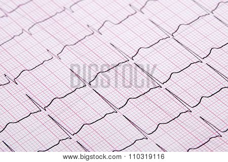 Close Up Of A Electrocardiograph Also Known As A Ekg