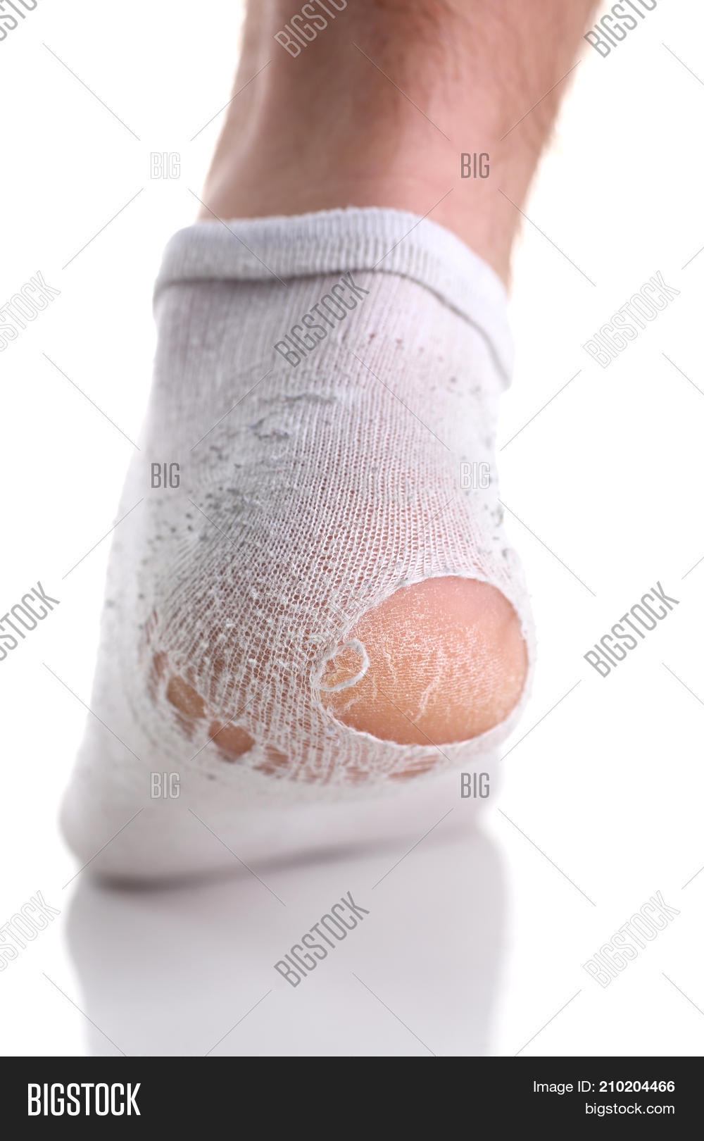 Ripped White Sock On Image & Photo (Free Trial) Bigstock