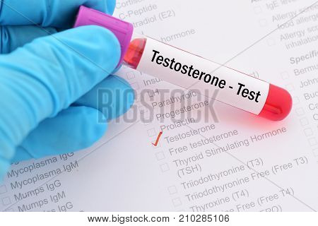 Blood sample with requisition form for testosterone hormone test