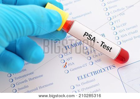 Blood sample with requisition form for PSA test