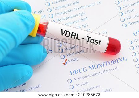 Blood sample with requisition form for VDRL test