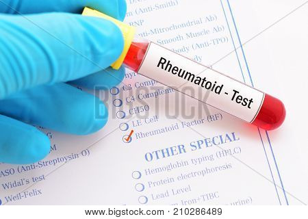 Blood sample with requisition form for rheumatoid factor test