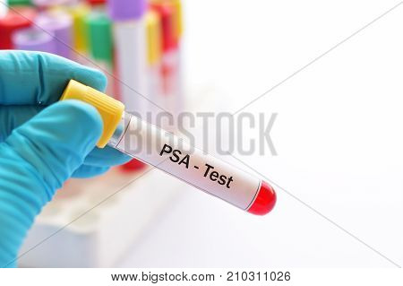 Test tube with blood sample for PSA test