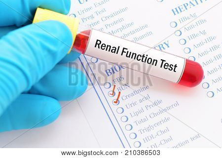 Blood sample with requisition form for renal function test