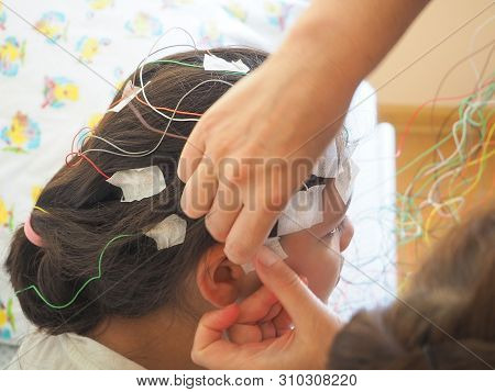 Girl With Eeg Electrodes Attached To Her Head For Medical Test