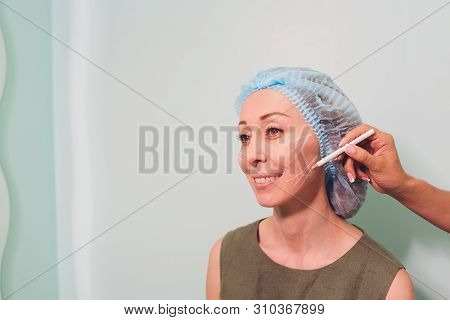 Aged Woman Doing Mesothreads And Thread Lifting, Cosmetology. Cosmetic Procedure To Eliminate Signs 
