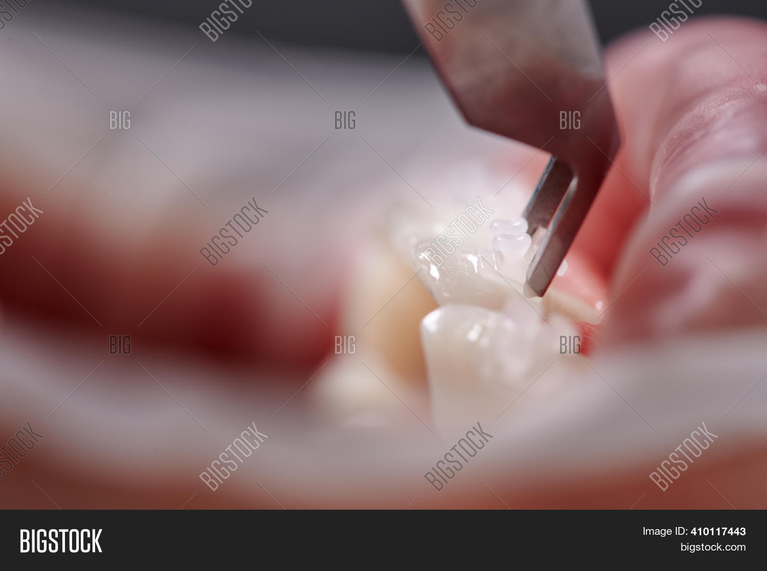 Close Orthodontist Image & Photo (Free Trial) Bigstock