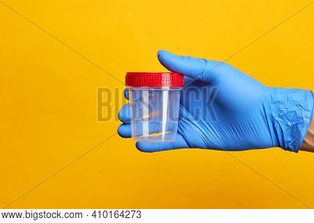 Medical Exam Concept. Perosn Holds Urine Test Cup Over Bright Yellow Background.