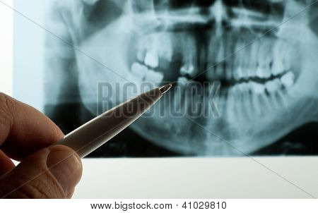 RTG stomatologiczne