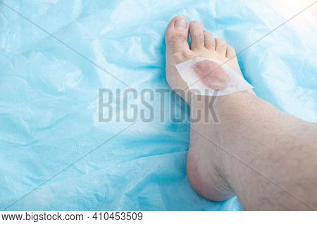 Depilatory Wax Strip For Hair Removal On Human Leg In Beauty Salon. Copy Space For Text, Sensitive S