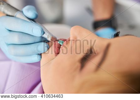 Prophy Cup Touching Tooth In Female Mouth
