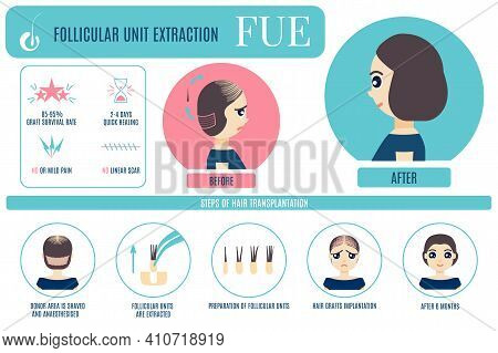 Fue Hair Treatment For Women Infographic Poster