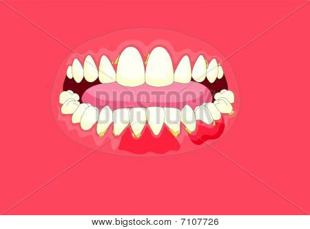 tooth