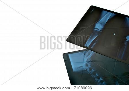 Radiography.
