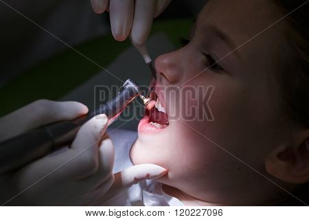 Girl Getting Her Teeth Polished