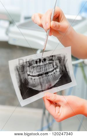 Dentist looking at x-ray picture