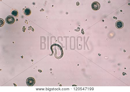 Toxocara canis and embryonated egg with larva