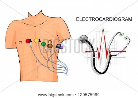 illustration of the electrocardiogram. the patient with electrodes on the chest.