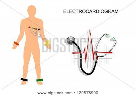 illustration of the electrocardiogram. the patient with electrodes on the chest.