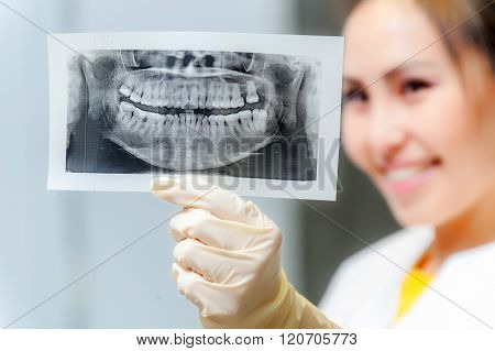 Dentist looking at x-ray picture