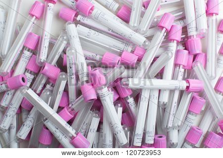 The new tube blood collection for hematology laboratory.