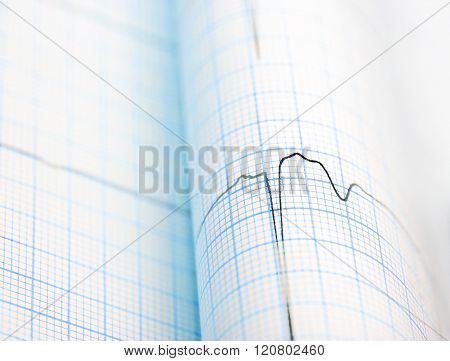 Ecg Curve Folded On Paper