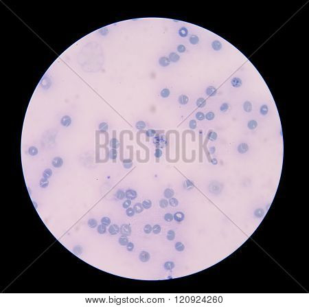 reticulocyte in blood smear medical scienct background.