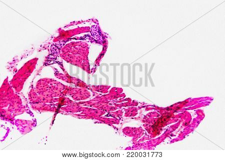 Cell Microscopic- Pyloric Division Stomach