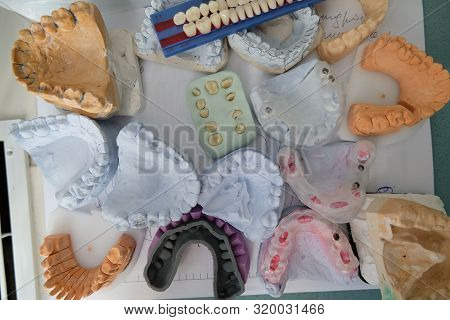 Dentoforms, Dental Tooth Model In Medical Cabinet