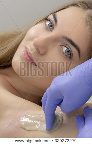 Sugaring: Epilation With Liquate Sugar At Armpit. Master Of Sugaring Making Hair Removal Procedure F