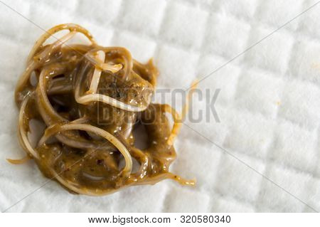 Feces With Toxocara Cati From A Stray Cat