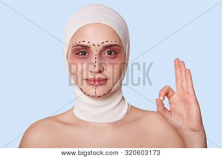 Close Up Portrait Of Young Woman With Bandaged Head And Correction Marks On Face, Female Showing Ok 