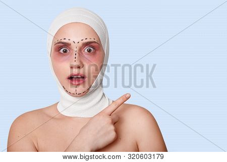 Studio Shot Of Beautiful Woman Before Plastic Surgery With Bandage On Head With Shocked Facial Expre