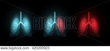 Lungs. World Asthma Day Concept. Banner Template With Glowing Low Poly. Futuristic Modern Abstract. 