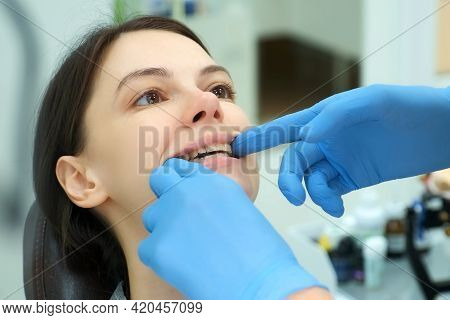 Orthodontist Doctor Checks Closing Of Womans Teeth Jaws With Silicone Invisible Transparent Trainer 